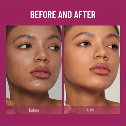 ERASER: New Sponge Head Concealer for Dark Circles Freckles Acne Pigmentation and Blemishes Long Lasting Moisturizing Liquid Foundation