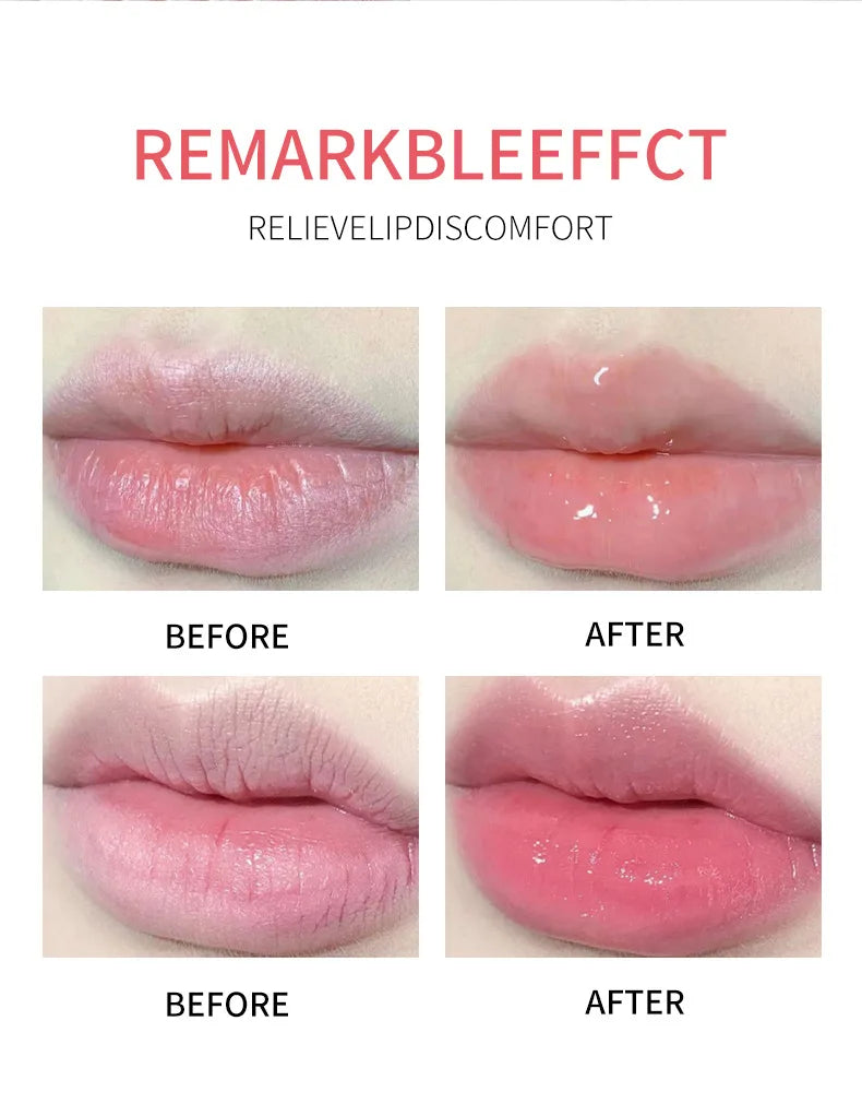 ADMD™ – Fruit Kiss Collection: 8-Piece Moisturising Lip Balm Set (Anti-Cracks)