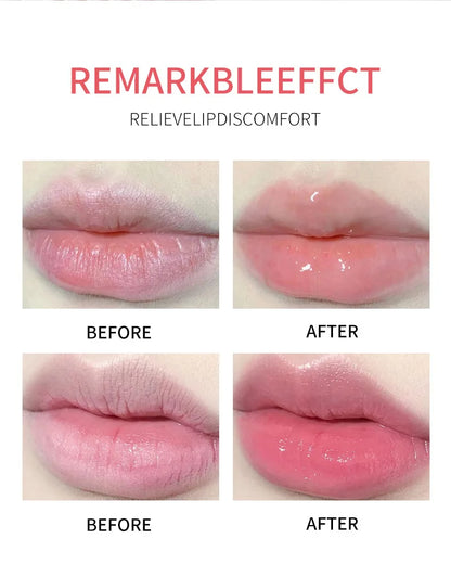 ADMD™ – Fruit Kiss Collection: 8-Piece Moisturising Lip Balm Set (Anti-Cracks)