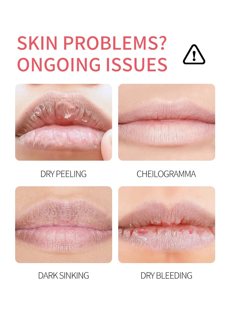 ADMD™ – Fruit Kiss Collection: 8-Piece Moisturising Lip Balm Set (Anti-Cracks)