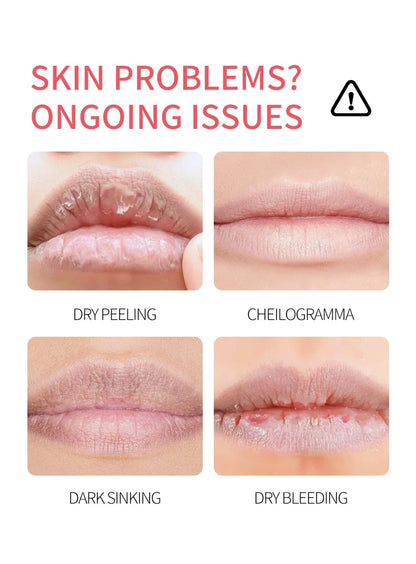 ADMD™ – Fruit Kiss Collection: 8-Piece Moisturising Lip Balm Set (Anti-Cracks)