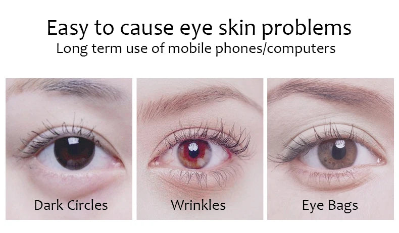 LUNIVA Eyes™Zoo-son: 60pcs Gold Crystal Collagen Eye Mask Beauty Moisturizing Firming Anti Dark Circles Eyes Bags Removal Eyes Care Eye Patches